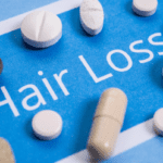 How to Reverse Hair Loss from Medications
