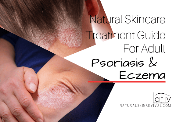 Glat lotteri lærling Psoriasis & Eczema Treatment Guide For Adults - Natural Skin Revival