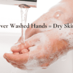How To Care For Irritated Skin From Over Washing