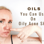 Can You Use Oil On Oily & Acne Skin?