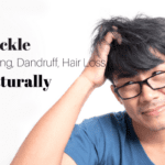 Say Goodbye to Itchy Scalp With Natural Remedies