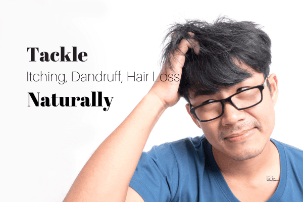 Say Goodbye to Itchy Scalp With Natural Remedies