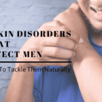 7 Skin Disorders That Affect Men