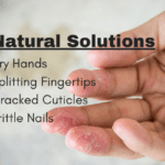 How To Heal Dry Cracked Hands, Fingertips & Cuticles
