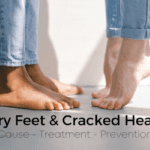 How to Fix Rough Dry Cracked Skin on Feet