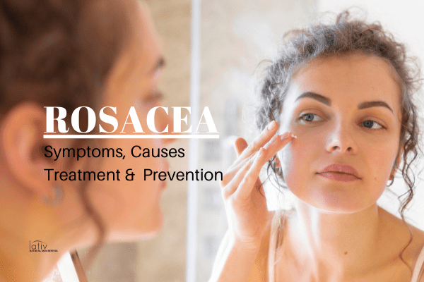 Treat and Manage Rosacea Without Medication