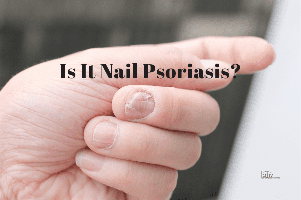6 Tips on Managing Nail Psoriasis