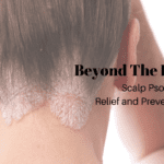 8 Tips For Washing Your Hair With Scalp Psoriasis