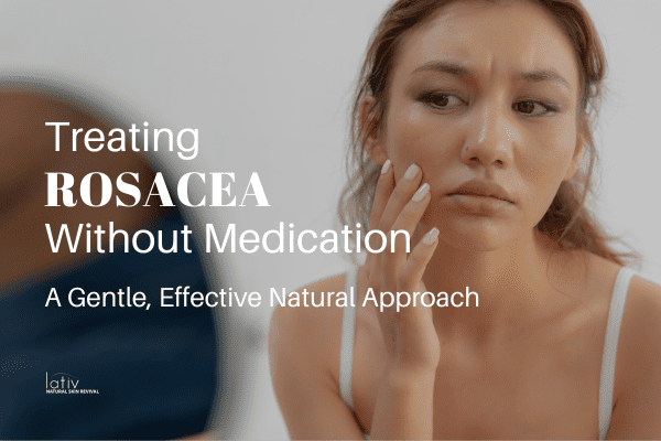 Treat Rosacea Without Medication