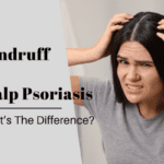 How to Distinguish Between Dandruff vs. Scalp Psoriasis
