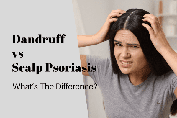 How to Distinguish Between Dandruff vs. Scalp Psoriasis