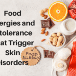 Food Allergies & Intolerances That Trigger Skin Disorders